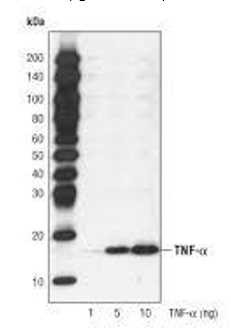 Anti-TNF monoclonal antibodies
