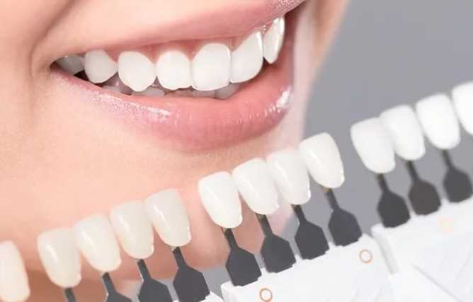 The Truth About Veneers: Know All The Facts