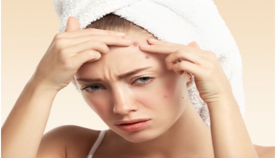 Find out the best treatments for acne| Tretinoin Or Adapalene?