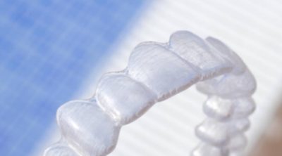 The Financial Considerations of Invisalign Treatment