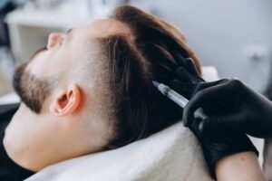 PRP Hair Treatment